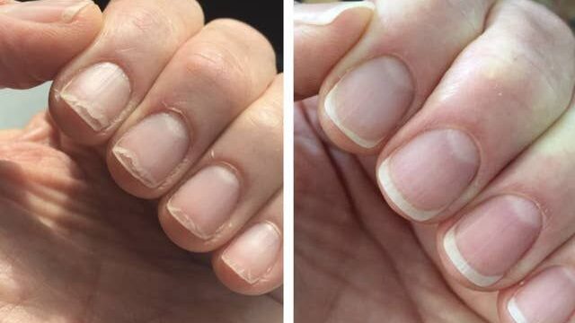 Top Nail Care Innovations to Try This Season