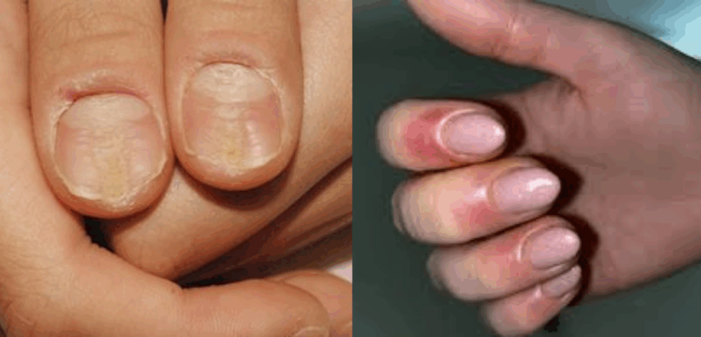 Hậu quả khôn lường từ việc sử dụng nailbox giả