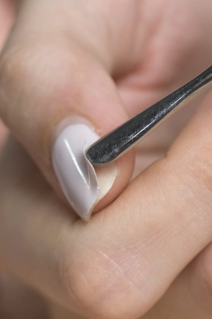 Không nên tiếp tục giữ móng đã bị bong tróc