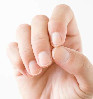 Hãy ngưng sử dụng nailbox khi móng tay bị khó chịu