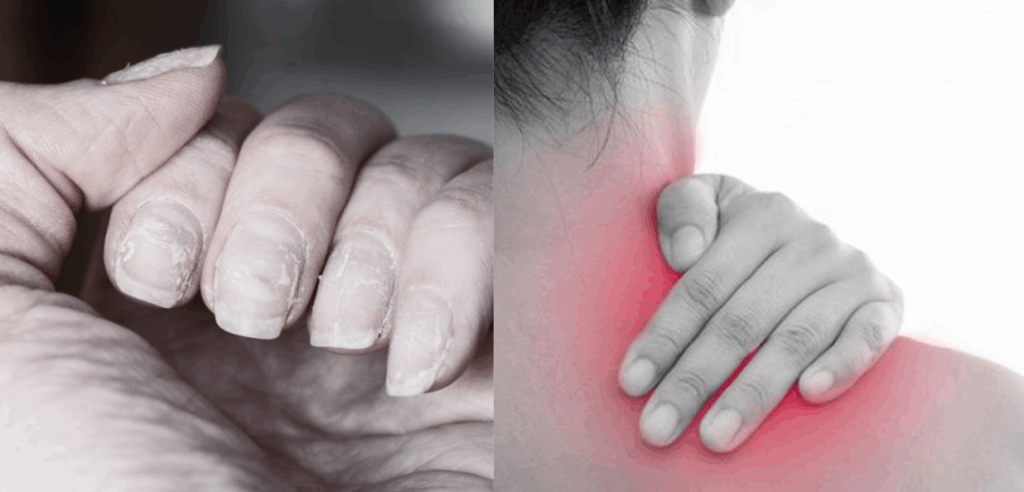 Rủi ro về sức khỏe của thợ làm nghề nail tại Việt Nam