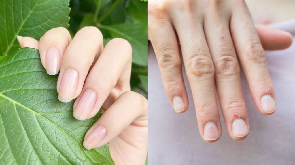 Móng tay là yếu tố phản ánh sức khỏe của bạn